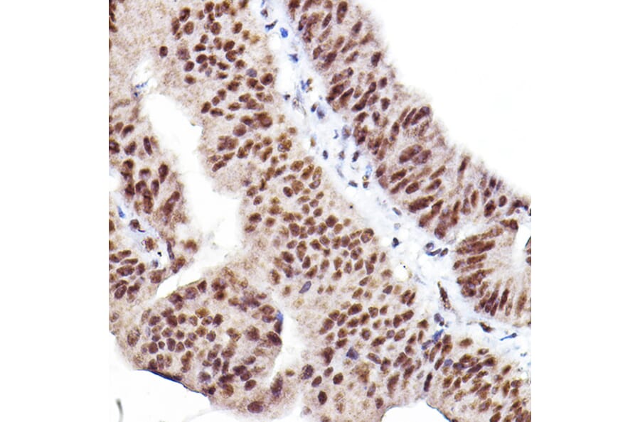 Immunohistochemistry - Anti-AKT1 +AKT2 + AKT3 (phospho Ser473) Antibody (A308315) - Antibodies.com