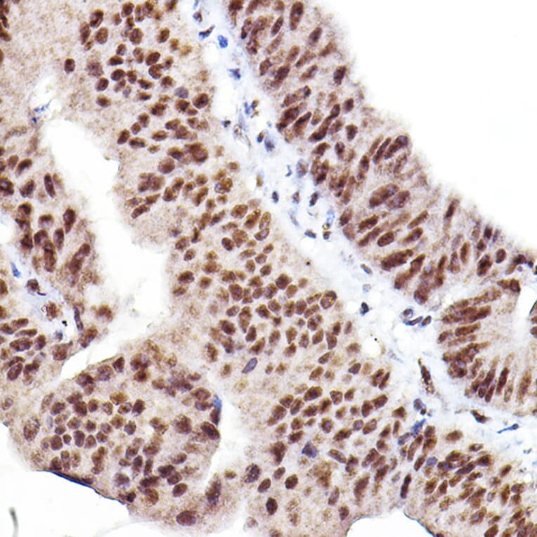 Immunohistochemistry - Anti-AKT1 +AKT2 + AKT3 (phospho Ser473) Antibody (A308315) - Antibodies.com