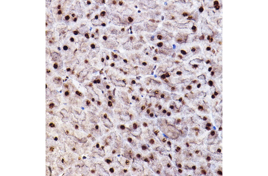 Immunohistochemistry - Anti-AKT1 +AKT2 + AKT3 (phospho Ser473) Antibody (A308315) - Antibodies.com