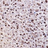Immunohistochemistry - Anti-AKT1 +AKT2 + AKT3 (phospho Ser473) Antibody (A308315) - Antibodies.com