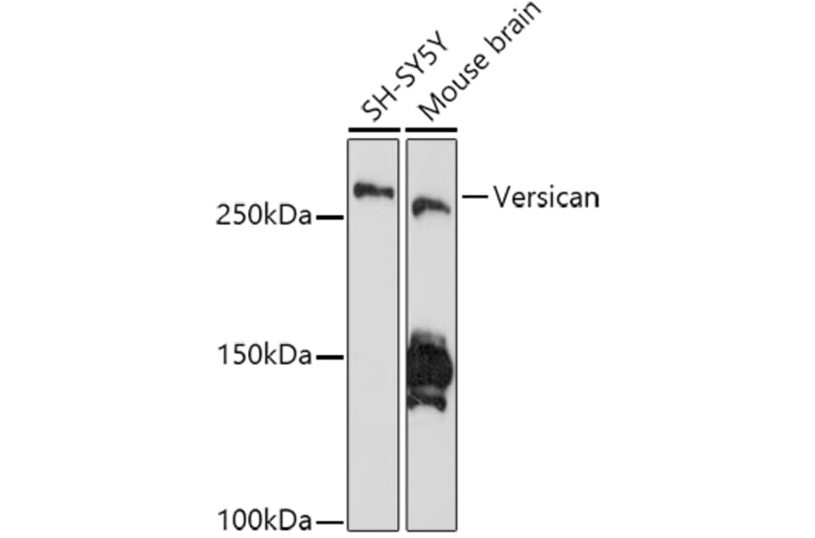 Western Blot - Anti-Versican Antibody [ARC2216] (A308316) - Antibodies.com