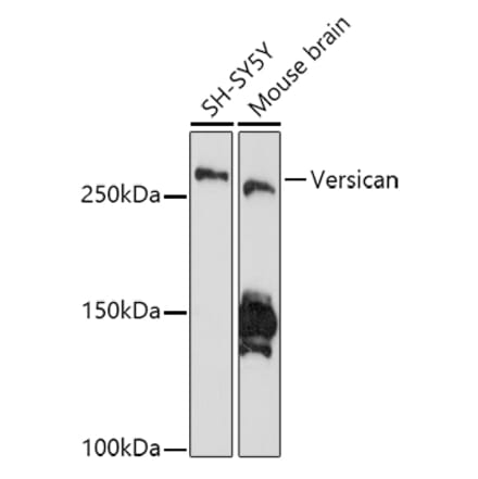 Western Blot - Anti-Versican Antibody [ARC2216] (A308316) - Antibodies.com