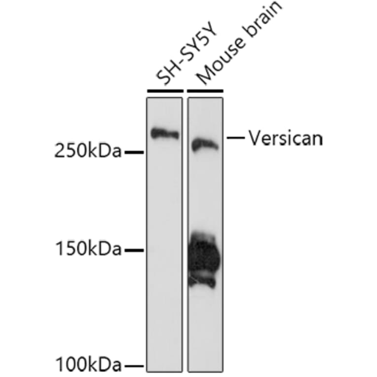 Western Blot - Anti-Versican Antibody [ARC2216] (A308316) - Antibodies.com