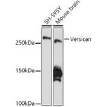 Western Blot - Anti-Versican Antibody [ARC2216] (A308316) - Antibodies.com