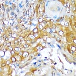 Immunohistochemistry - Anti-Versican Antibody [ARC2216] (A308316) - Antibodies.com