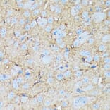 Immunohistochemistry - Anti-Versican Antibody [ARC2216] (A308316) - Antibodies.com