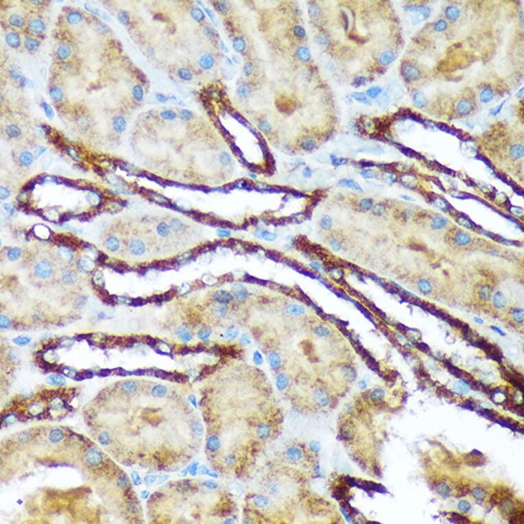 Immunohistochemistry - Anti-Versican Antibody [ARC2216] (A308316) - Antibodies.com