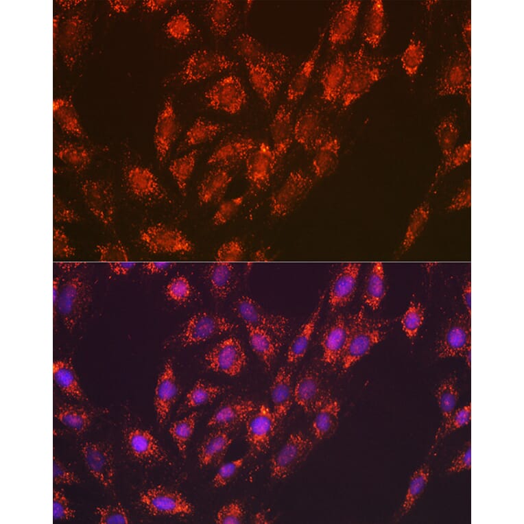 Immunofluorescence - Anti-Versican Antibody [ARC2216] (A308316) - Antibodies.com