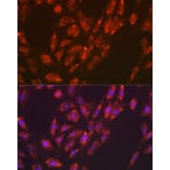 Immunofluorescence - Anti-Versican Antibody [ARC2216] (A308316) - Antibodies.com