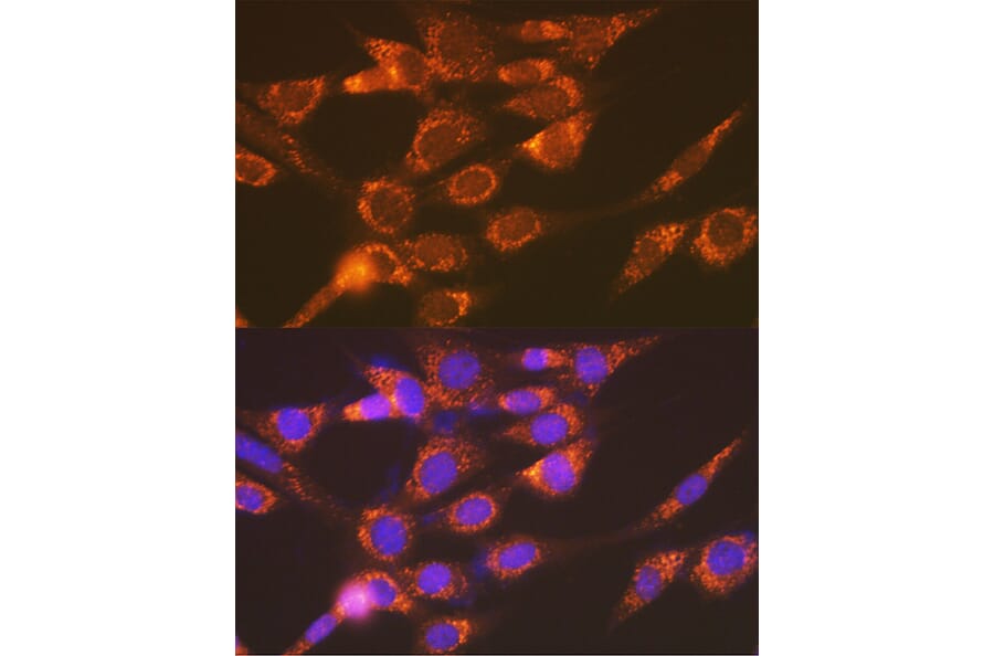 Immunofluorescence - Anti-Versican Antibody [ARC2216] (A308316) - Antibodies.com