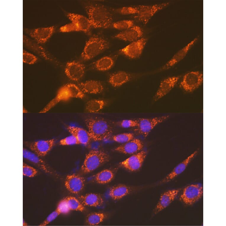 Immunofluorescence - Anti-Versican Antibody [ARC2216] (A308316) - Antibodies.com