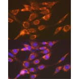 Immunofluorescence - Anti-Versican Antibody [ARC2216] (A308316) - Antibodies.com