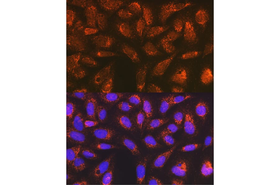 Immunofluorescence - Anti-Versican Antibody [ARC2216] (A308316) - Antibodies.com