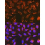 Immunofluorescence - Anti-Versican Antibody [ARC2216] (A308316) - Antibodies.com