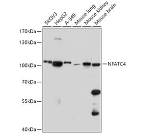 Western Blot - Anti-NFATC4 Antibody (A308318) - Antibodies.com