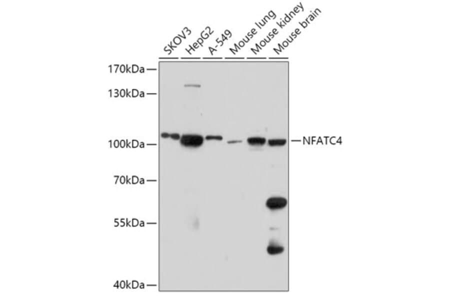 Western Blot - Anti-NFATC4 Antibody (A308318) - Antibodies.com