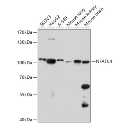 Western Blot - Anti-NFATC4 Antibody (A308318) - Antibodies.com