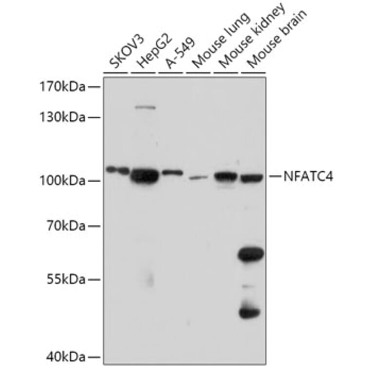 Western Blot - Anti-NFATC4 Antibody (A308318) - Antibodies.com