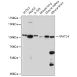 Western Blot - Anti-NFATC4 Antibody (A308318) - Antibodies.com