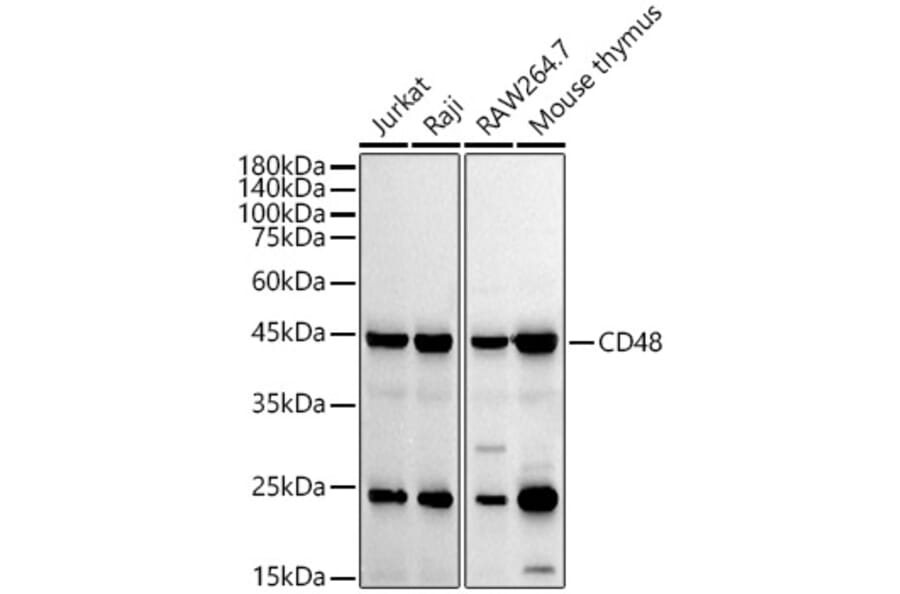 Western Blot - Anti-CD48 Antibody [ARC53030] (A308320) - Antibodies.com
