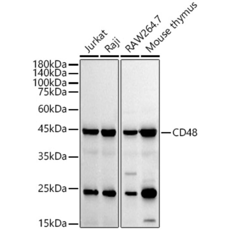 Western Blot - Anti-CD48 Antibody [ARC53030] (A308320) - Antibodies.com
