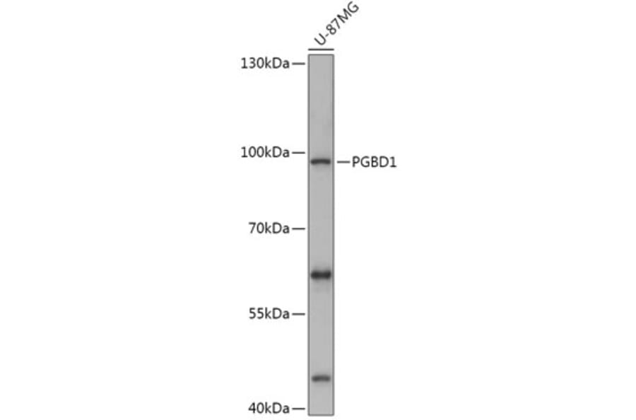 Western Blot - Anti-PGBD1 Antibody (A308322) - Antibodies.com