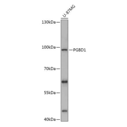 Western Blot - Anti-PGBD1 Antibody (A308322) - Antibodies.com