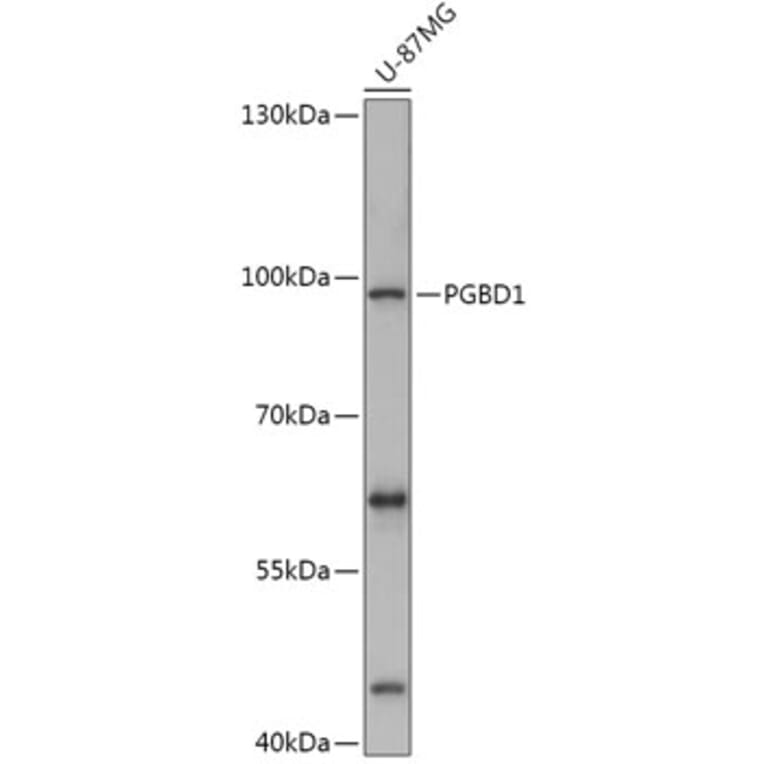 Western Blot - Anti-PGBD1 Antibody (A308322) - Antibodies.com
