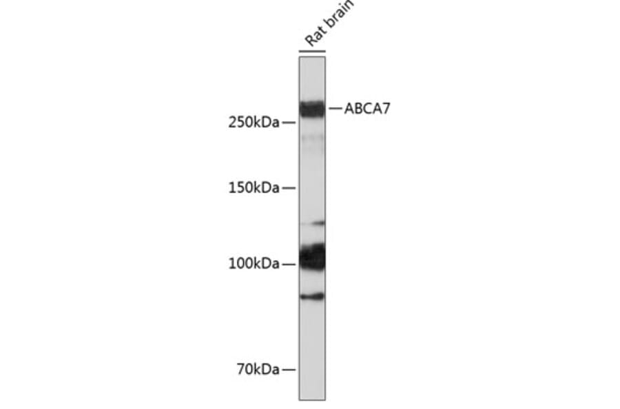 Western Blot - Anti-ABCA7 Antibody (A308323) - Antibodies.com