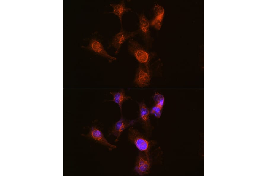 Immunofluorescence - Anti-ABCA7 Antibody (A308323) - Antibodies.com