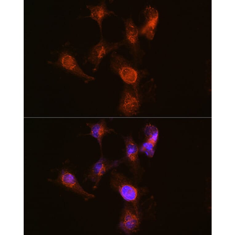 Immunofluorescence - Anti-ABCA7 Antibody (A308323) - Antibodies.com