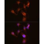 Immunofluorescence - Anti-ABCA7 Antibody (A308323) - Antibodies.com