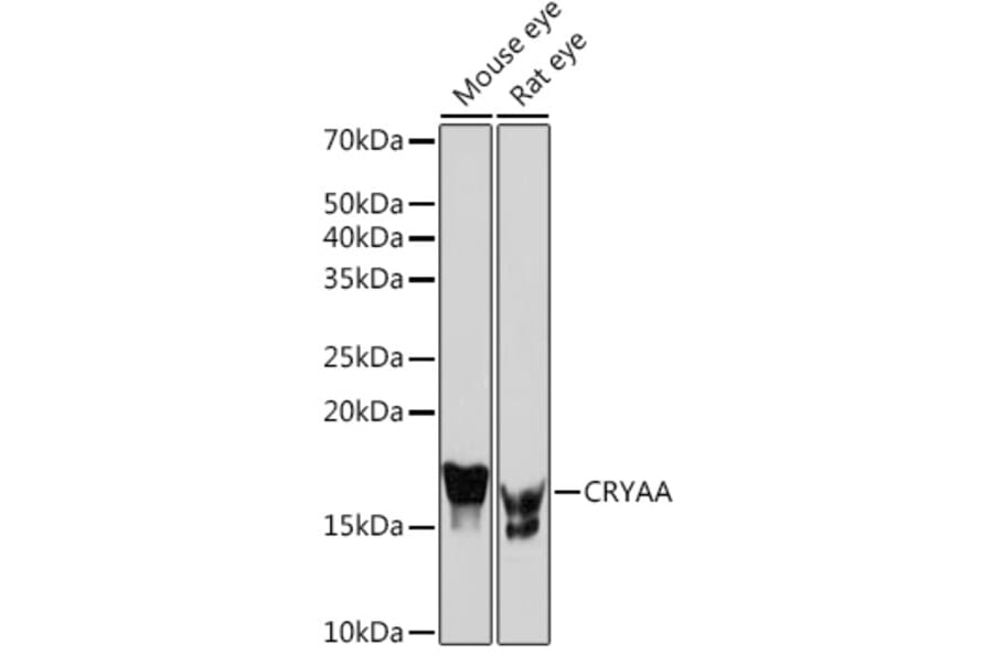 Western Blot - Anti-alpha A Crystallin/CRYAA Antibody (A308325) - Antibodies.com