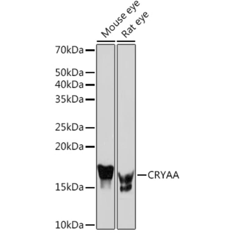 Western Blot - Anti-alpha A Crystallin/CRYAA Antibody (A308325) - Antibodies.com