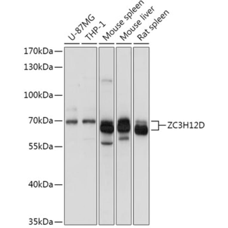 Western Blot - Anti-ZC3H12D Antibody (A308326) - Antibodies.com