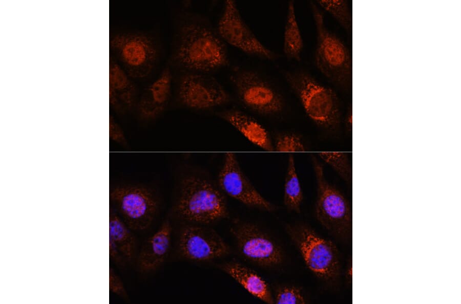 Immunofluorescence - Anti-ZC3H12D Antibody (A308326) - Antibodies.com