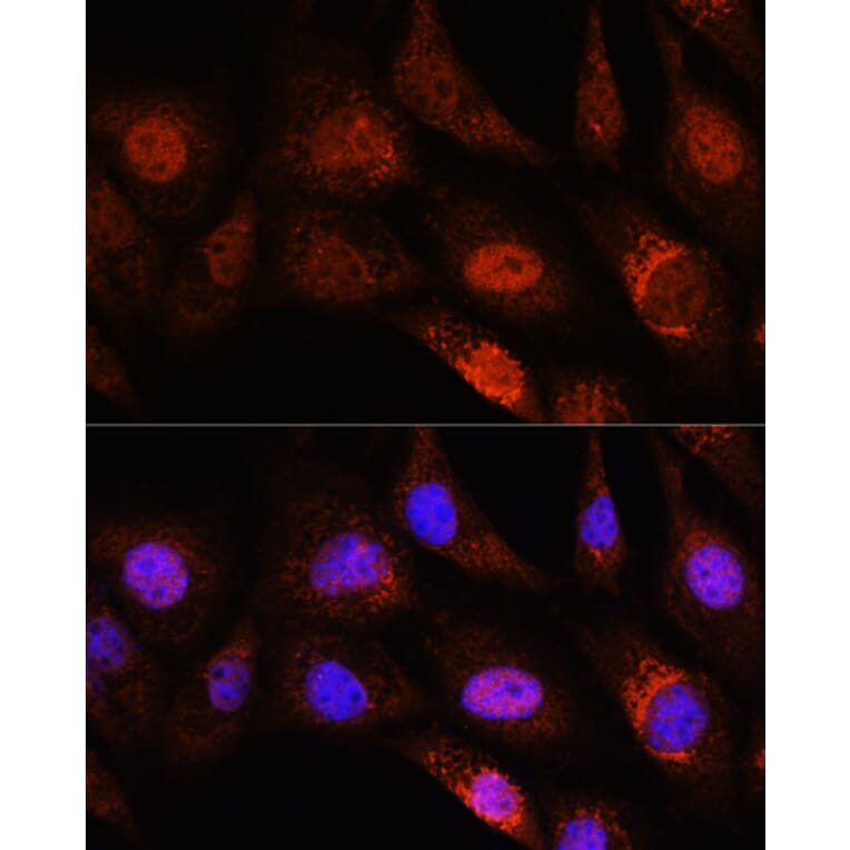 Immunofluorescence - Anti-ZC3H12D Antibody (A308326) - Antibodies.com