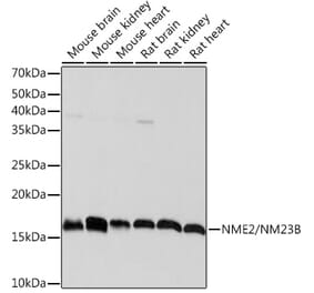 Western Blot - Anti-NME2 Antibody [ARC1412] (A308328) - Antibodies.com