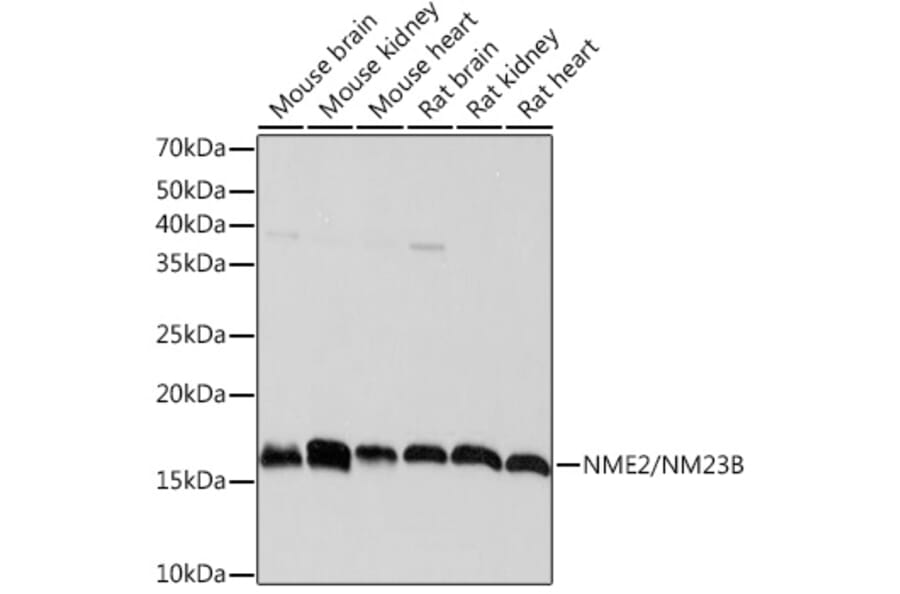 Western Blot - Anti-NME2 Antibody [ARC1412] (A308328) - Antibodies.com