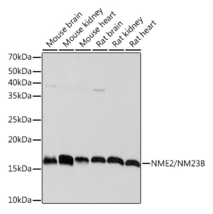 Western Blot - Anti-NME2 Antibody [ARC1412] (A308328) - Antibodies.com