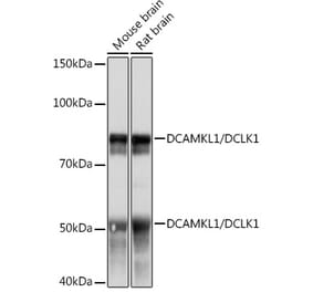 Western Blot - Anti-DCAMKL1 Antibody [ARC0984] (A308329) - Antibodies.com