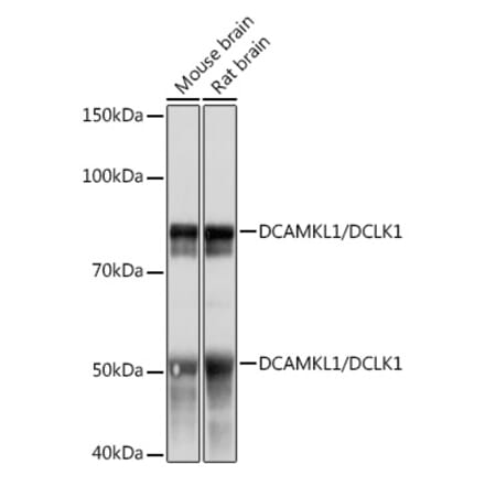 Western Blot - Anti-DCAMKL1 Antibody [ARC0984] (A308329) - Antibodies.com