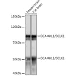 Western Blot - Anti-DCAMKL1 Antibody [ARC0984] (A308329) - Antibodies.com