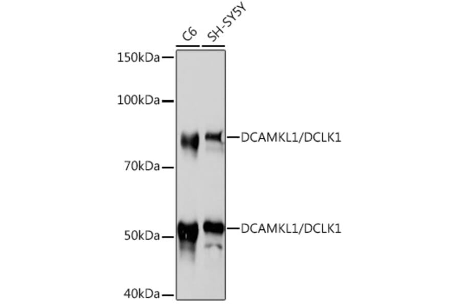 Western Blot - Anti-DCAMKL1 Antibody [ARC0984] (A308329) - Antibodies.com
