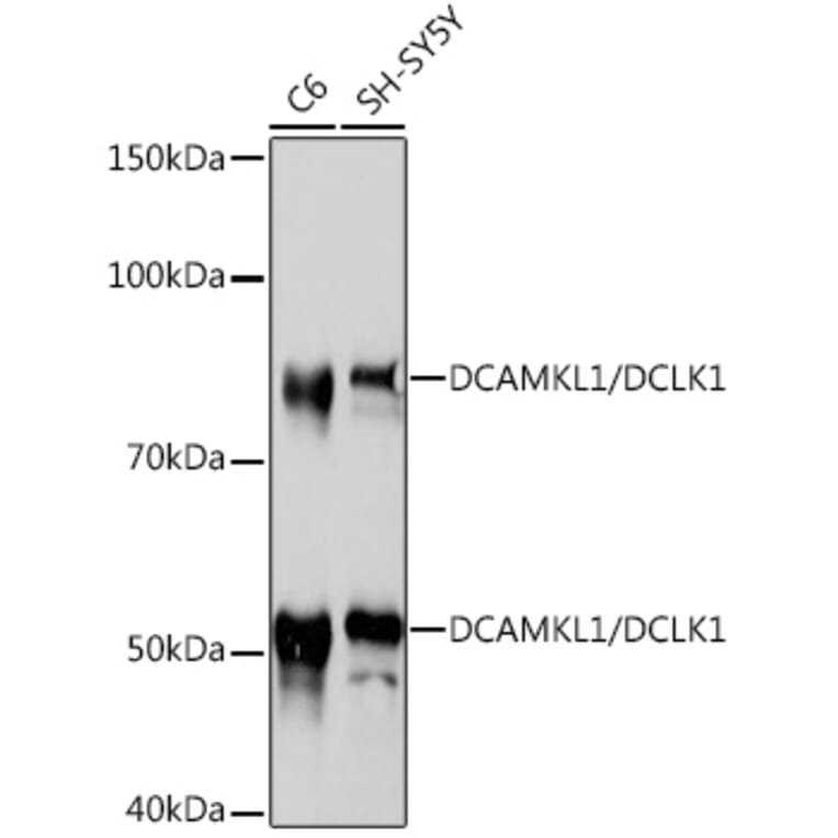 Western Blot - Anti-DCAMKL1 Antibody [ARC0984] (A308329) - Antibodies.com