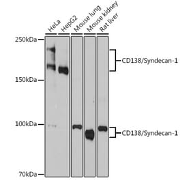 Western Blot - Anti-Syndecan-1 Antibody [ARC0918] (A308330) - Antibodies.com