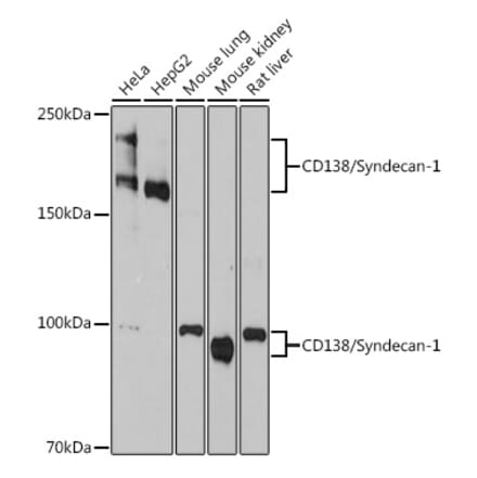 Western Blot - Anti-Syndecan-1 Antibody [ARC0918] (A308330) - Antibodies.com