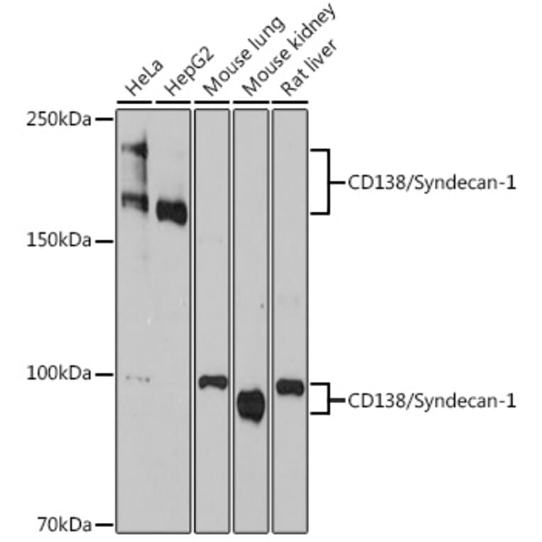 Western Blot - Anti-Syndecan-1 Antibody [ARC0918] (A308330) - Antibodies.com