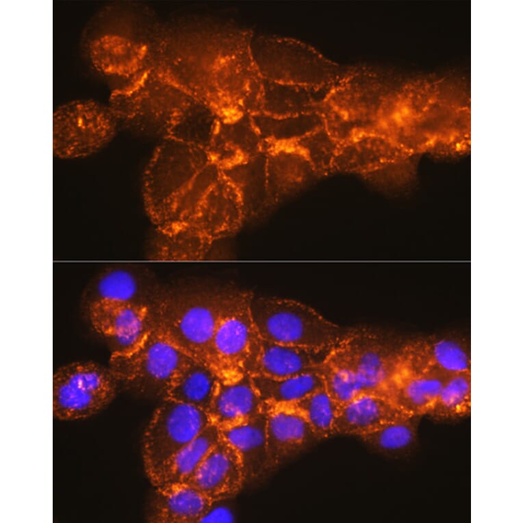 Immunofluorescence - Anti-Syndecan-1 Antibody [ARC0918] (A308330) - Antibodies.com