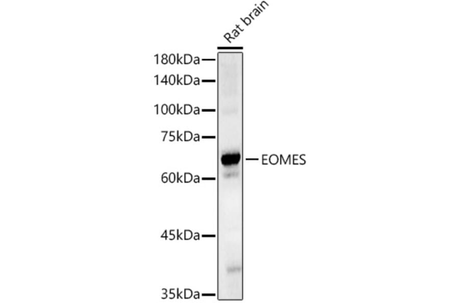 Western Blot - Anti-TBR2/Eomes Antibody (A308331) - Antibodies.com